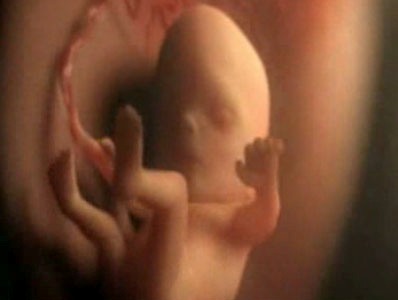 Hamilelikte 5.Ay 16-20 Hafta