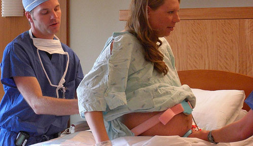 Epidural Anestezi ile ‘Ağrısız Doğum’