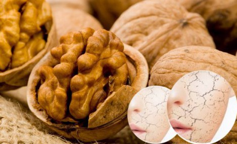 Cilt Kuruluğunu Önlemek İçin Ceviz Tüketin
