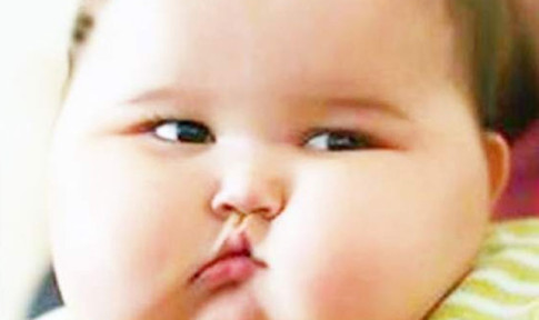 Erkeklerdeki Obeziteye Kadın Hormonları Yol Açıyor