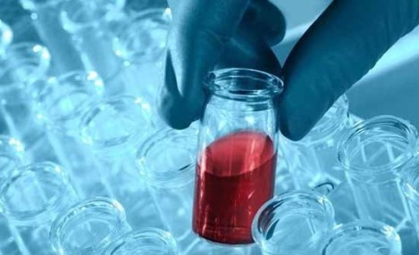 5 Yaş Altı Ölümlerin Yüzde 60’ı Sepsis Kaynaklı