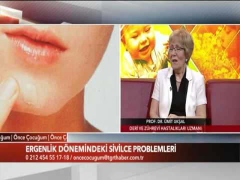 Bebeklik Döneminde Ergenlik Sivilcesi