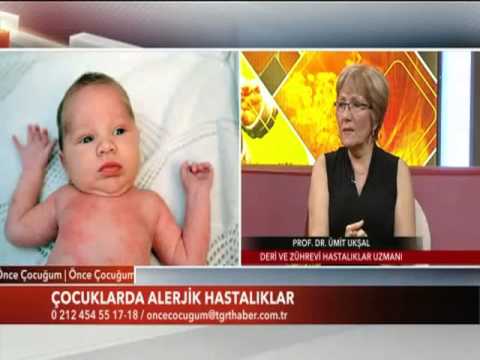Alerjilerin Tedavisi Nasıl Yapılıyor?