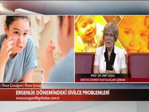 Ergenlik Sivilcelerinin Tedavisi