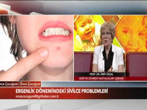 Beslenme Sivilceyi Etkiler mi?
